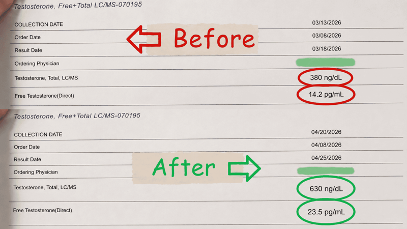 Before and after testosterone lab results